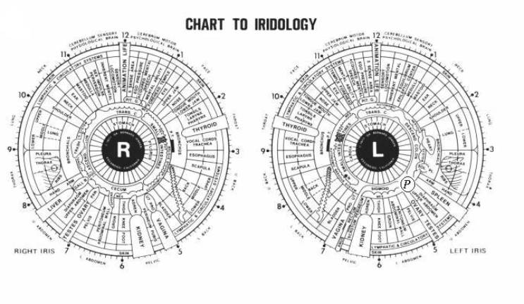 Dr Bernard Jensen Iridology Chart